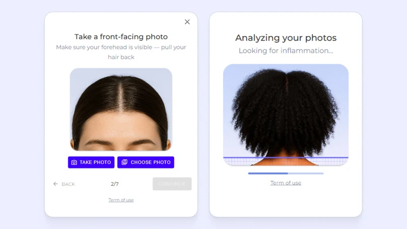 iHairium – AI Hair Analysis